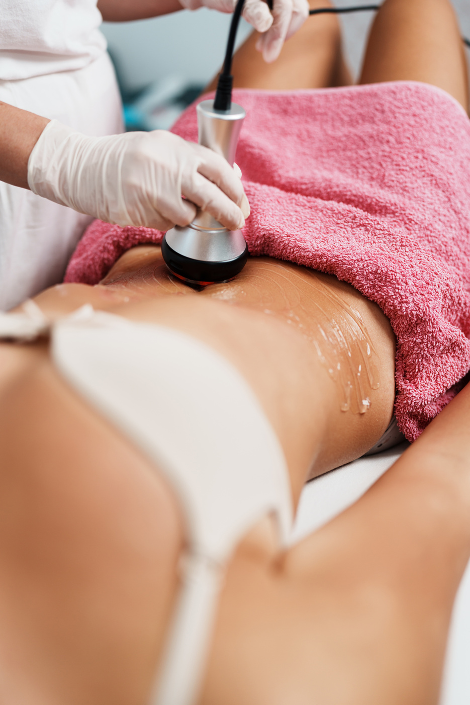 RF Body cavitation treatment